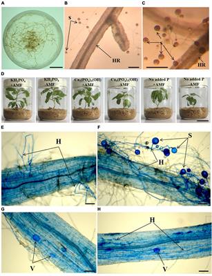 Arbuscular Mycorrhizal Fungi Contribute to Phosphorous Uptake and Allocation Strategies of Solidago canadensis in a Phosphorous-Deficient Environment